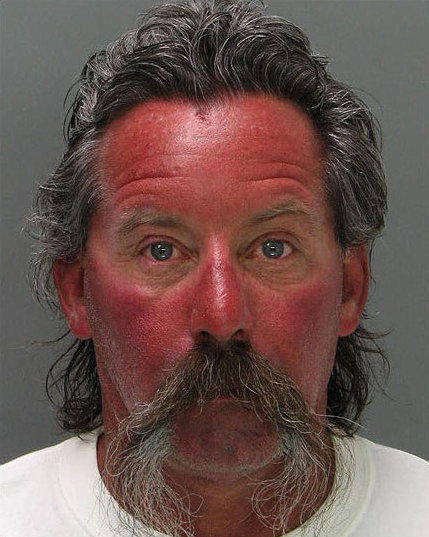 01-Amazing-Mugshots-of-Normal-People-Sunburn.jpg